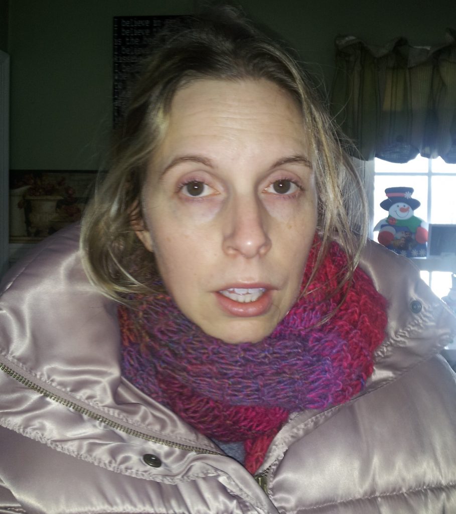 I felt HORRIBLE in this pic and was so sick of being down and out of it! Happy to take anything I can not to get back to this yucky place!